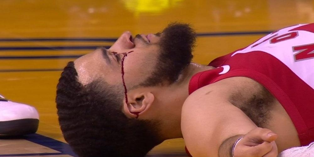 Fred VanVleet