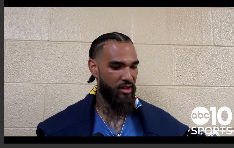 Willie Cauley-Stein