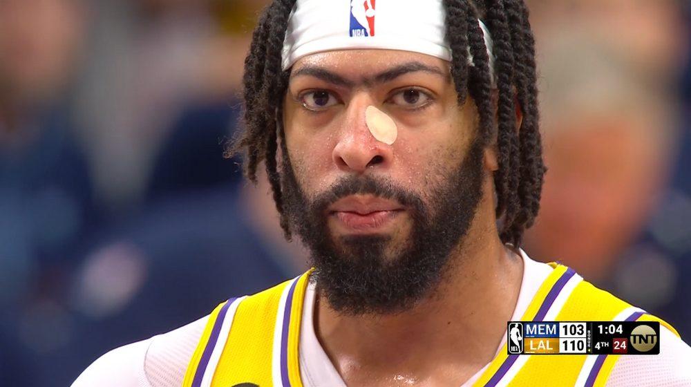 Anthony Davis